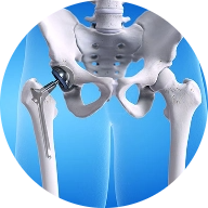 Knee Arthroscopy