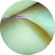 Knee Arthroscopic Surgeries