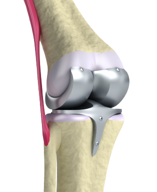 Comprehensive Orthopedic Care